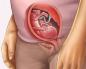 Vad är det för fel på denna term: cystit och placenta previa